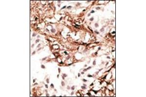 anti-Microtubule-Associated Protein 1 Light Chain 3 gamma (MAP1LC3C) (AA 1-30), (N-Term) antibody