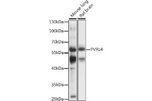 Western blot analysis of extracts of various cell lines, using PVRL4 antibody (ABIN7269433) at 1:1000 dilution. (PVRL4 anticorps  (AA 371-510))