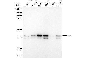 Western blotting analysis using TIA1 antibody (ABIN7800557). (Recombinant TIA1 anticorps)