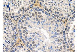 ABIN6260374 and ABIN6279100 at 1/100 staining Mouse testis tissue by IHC-P. (RPP25L anticorps  (C-Term))