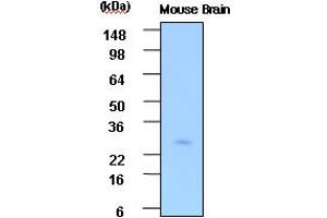 Western blot analysis: Cell lysates of Mouse brain(30ug) were resolved by SDS-PAGE, transferred to PVDF membrane and probed with anti-human PSP (1:1000). (STXBP3 anticorps)