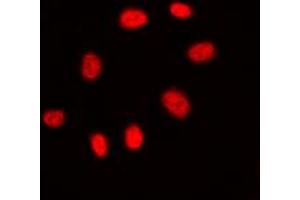 Immunofluorescent analysis of CDC25C staining in A431 cells. (CDC25C anticorps  (Center))
