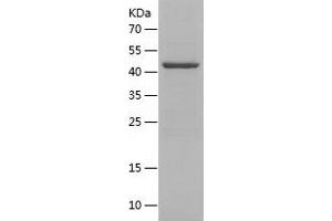Western Blotting (WB) image for Nephrosis 1, Congenital, Finnish Type (Nephrin) (NPHS1) (AA 23-257) protein (His-IF2DI Tag) (ABIN7124129)
