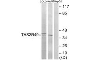 Western blot analysis of extracts from COLO/HepG2 cells, using TAS2R49 Antibody. (TAS2R20 anticorps  (AA 94-143))