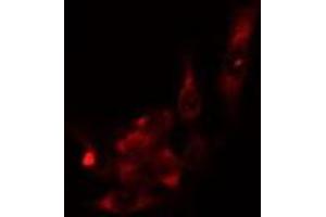 anti-Aldo-Keto Reductase Family 1, Member B1 (Aldose Reductase) (AKR1B1) (C-Term) antibody