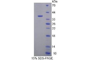 SDS-PAGE analysis of Human EEF1d Protein. (EEF1D Protéine)