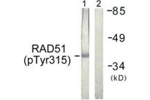 Western blot analysis of extracts from Jurkat cells, using RAD51 (Phospho-Tyr315) Antibody. (RAD51 anticorps  (pSer315))