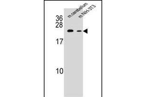 RAB12 Antibody (N-term) (ABIN655307 and ABIN2844889) western blot analysis in mouse cerebellum tissue and mouse NIH-3T3 cell line lysates (35 μg/lane). (RAB12 anticorps  (N-Term))