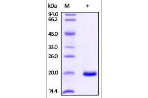 Non-Metastatic Cells 1, Protein (NM23A) Expressed in (NME1) (AA 2-152) protein (His tag)