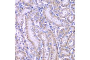 Immunohistochemistry of paraffin-embedded rat kidney using ACAA1 antibody at dilution of 1:100 (x400 lens). (ACAA1 anticorps)