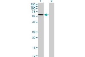 Western Blot analysis of ARSA expression in transfected 293T cell line by ARSA MaxPab polyclonal antibody. (Arylsulfatase A anticorps  (AA 1-507))