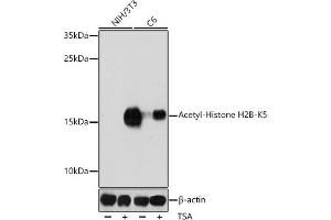 Western blot analysis of extracts of various cell lines, using Acetyl-Histone H2B-K5 antibody (ABIN7267733) at 1:1000 dilution. (Histone H2B anticorps  (acLys5))