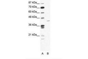 Image no. 1 for anti-Zinc Finger Protein 568 (ZNF568) (AA 121-170) antibody (ABIN202378) (ZNF568 anticorps  (AA 121-170))