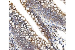 IHC analysis of ETF/TEAD2 using anti-ETF/TEAD2 antibody (ABIN7599879).