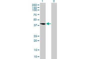 Western Blot analysis of FCER2 expression in transfected 293T cell line by FCER2 MaxPab polyclonal antibody.