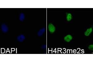 Immunofluorescence analysis of 293T cell using H4R3me2s antibody. (Histone 3 anticorps  (2meArg3))