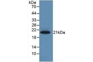 Detection of Recombinant CBG, Rat using Monoclonal Antibody to Corticosteroid Binding Globulin (CBG) (SERPINA6 anticorps  (AA 173-344))