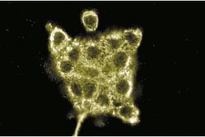 Immunofluorescence staining of A431 cells (human epithelial carcinoma, ATCC CRL-1555). (AKAP9 anticorps  (AA 17-130))