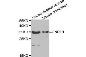 Western Blotting (WB) image for anti-Gonadotropin-Releasing Hormone 1 (Luteinizing-Releasing Hormone) (GNRH1) antibody (ABIN1876826)