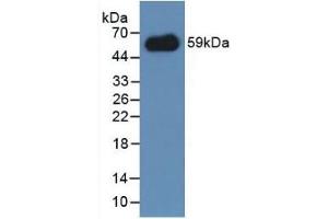 Detection of Recombinant IREM1, Mouse using Polyclonal Antibody to Immune Receptor Expressed On Myeloid Cells 1 (IREM1) (IREM1 anticorps  (AA 45-310))