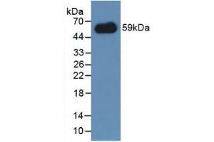 Detection of Recombinant IREM1, Mouse using Polyclonal Antibody to Immune Receptor Expressed On Myeloid Cells 1 (IREM1) (IREM1 anticorps  (AA 45-310))