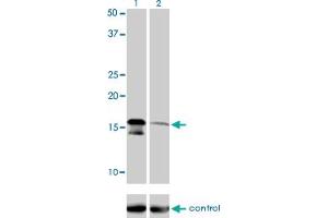 Western blot analysis of AGTRAP over-expressed 293 cell line, cotransfected with AGTRAP Validated Chimera RNAi (Lane 2) or non-transfected control (Lane 1). (AGTRAP anticorps  (AA 108-159))