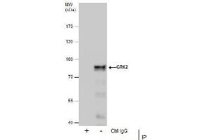 IP Image Immunoprecipitation of GRK2 protein from Jurkat whole cell extracts using 5 μg of GRK2 antibody [C2C3], C-term, Western blot analysis was performed using GRK2 antibody [C2C3], C-term, EasyBlot anti-Rabbit IgG  was used as a secondary reagent.