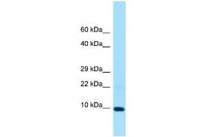 WB Suggested Anti-LSM5 Antibody Titration: 1. (LSM5 anticorps  (Middle Region))