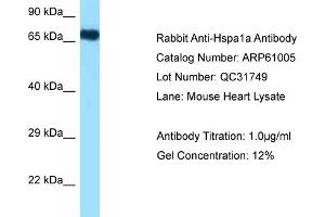 Western Blotting (WB) image for anti-Heat Shock 70kDa Protein 1A (HSPA1A) (N-Term) antibody (ABIN2788649) (HSP70 1A anticorps  (N-Term))