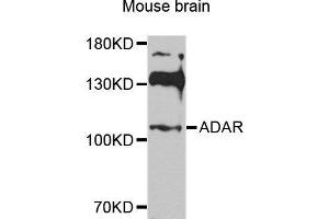 Western blot analysis of extracts of various cell lines, using ADAR antibody. (ADAR anticorps  (AA 150-250))