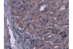 IHC-P analysis of Mouse Stomach Tissue, with DAB staining. (MARS anticorps  (AA 74-212))