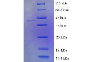 SDS-PAGE (SDS) image for LIM Domain Containing 2 (LIMD2) (AA 1-127), (full length) protein (GST tag) (ABIN5709865)
