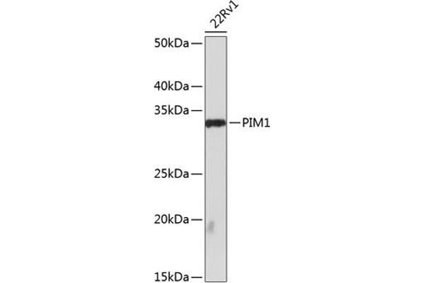 PIM1 anticorps