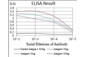 anti-Wilms Tumor 1 (WT1) (AA 314-479) antibody