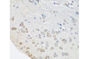 Immunohistochemistry of paraffin-embedded Mouse brain using PUM1 Polyclonal Antibody at dilution of 1:100 (40x lens). (PUM1 anticorps)