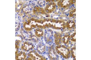 Immunohistochemistry of paraffin-embedded mouse kidney using AMPKβ1 antibody (ABIN6134216, ABIN6146175, ABIN6146177 and ABIN6223916) at dilution of 1:100 (40x lens). (PRKAB1 anticorps)