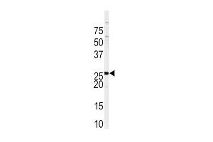 Western blot analysis of anti-SPRY4 Antibody (C-term) (ABIN391651 and ABIN2841559) in Sk-Br-3 cell line lysates (35 μg/lane).