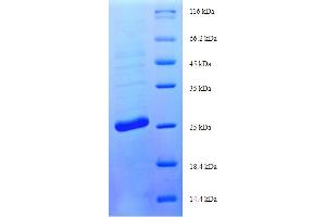 SDS-PAGE (SDS) image for Stimulator of Chondrogenesis 1 (SCRG1) (AA 21-98) protein (His-SUMO Tag) (ABIN5711205)