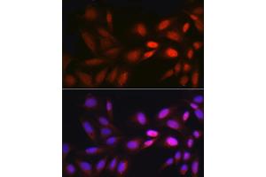 Immunofluorescence analysis of U2OS cells using EGR1 Rabbit pAb (ABIN3016527, ABIN3016528, ABIN3016529 and ABIN1679679) at dilution of 1:250 (40x lens). (EGR1 anticorps)