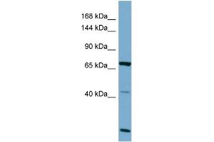 Host:  Rabbit  Target Name:  OCA2  Sample Type:  OVCAR-3 Whole cell lysates  Antibody Dilution:  1. (OCA2 anticorps  (C-Term))
