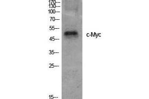 Western Blot (WB) analysis of specific cells using c-Myc Polyclonal Antibody. (c-MYC anticorps  (Ser95))