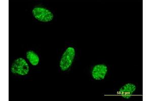 Immunofluorescence of monoclonal antibody to PPIG on HeLa cell. (PPIG anticorps  (AA 13-106))