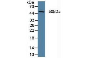 Figure. (ERCC5 anticorps  (AA 778-986))