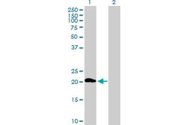 ZDHHC7 antibody  (AA 1-208)