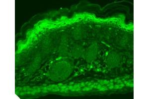Immunohistochemistry analysis using Mouse Anti-TrpV3 Monoclonal Antibody, Clone N15/4 (ABIN361778).