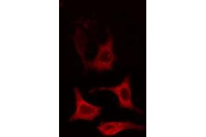 ABIN6274651 staining HT29 cells by IF/ICC. (CYP2R1 anticorps  (Internal Region))