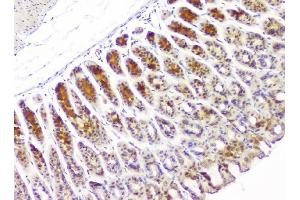 IHC analysis of HECTD3 using anti-HECTD3 antibody (ABIN6719595).