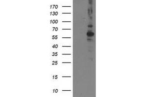 Western Blotting (WB) image for anti-Protein Phosphatase, Mg2+/Mn2+ Dependent, 1B (PPM1B) antibody (ABIN1500376) (PPM1B anticorps)