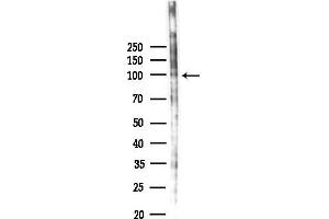 Western blot analysis of lysates from EC304 cells(starvation 24h treatment), using Phospho-beta Catenin (Tyr489) Antibody at 1/1000 dilution.
