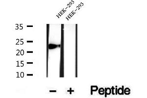 Western blot analysis of extracts of HEK-293 cells, using CYPC antibody. (PPIC anticorps  (Internal Region))
